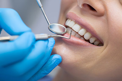 Almaden Valley Smile Design | Dental Implants, Crowns  amp  Bridges and Full Mouth Reconstruction