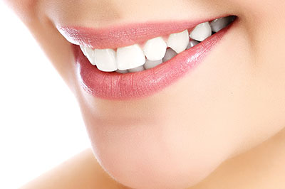 Almaden Valley Smile Design | Veneers, Dental Fillings and ZOOM  Whitening