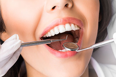 Almaden Valley Smile Design | Dentures, Root Canals and Implant Restorations