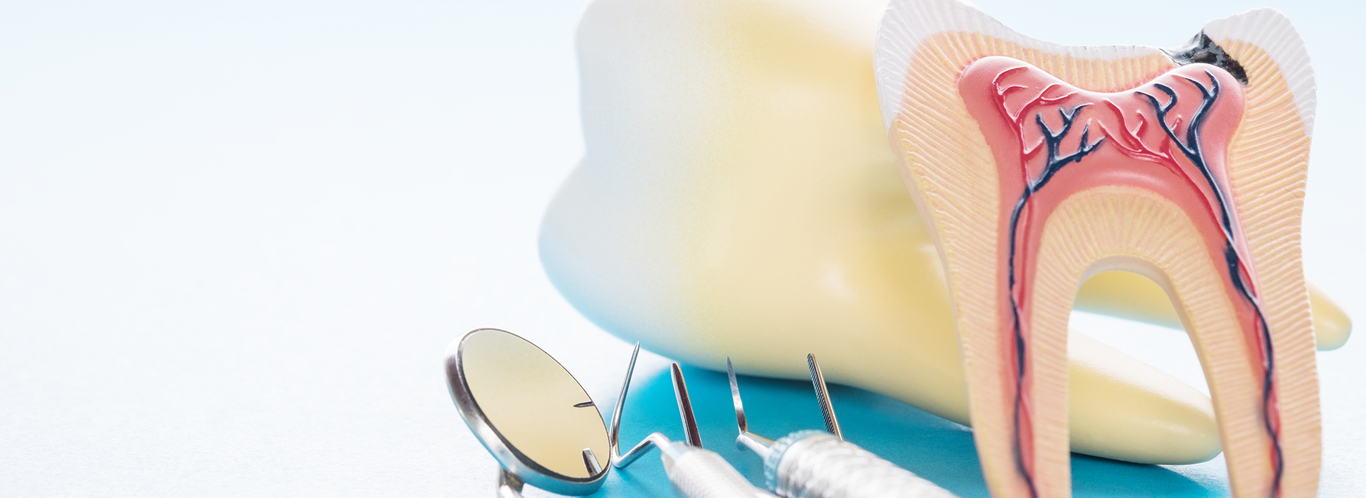 Almaden Valley Smile Design | Smile Makeover, All-on-6 reg  and Dental Implants