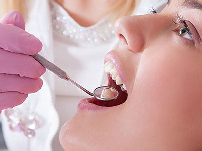 Almaden Valley Smile Design | Bone Grafts and Sinus Lifts, Teeth-In-A-Day and Dental Fillings