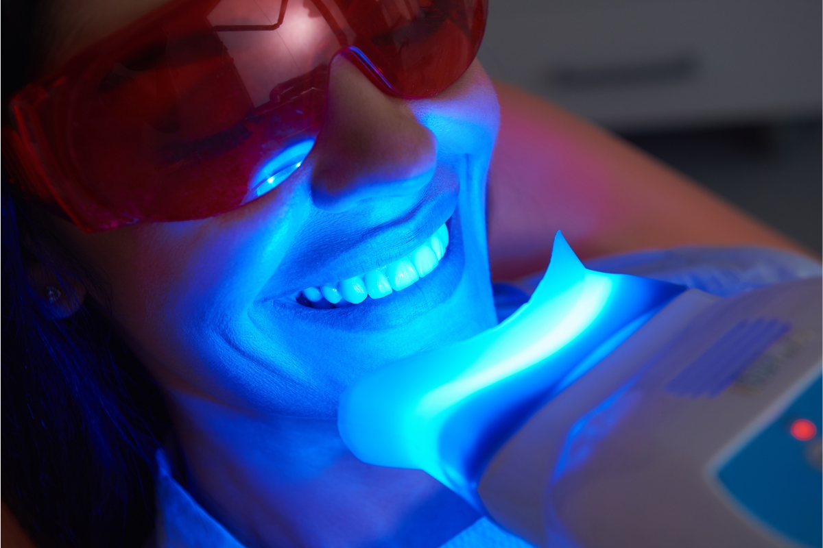 Zoom teeth whitening in San Jose