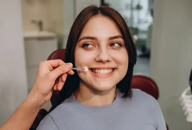 Porcelain Veneers