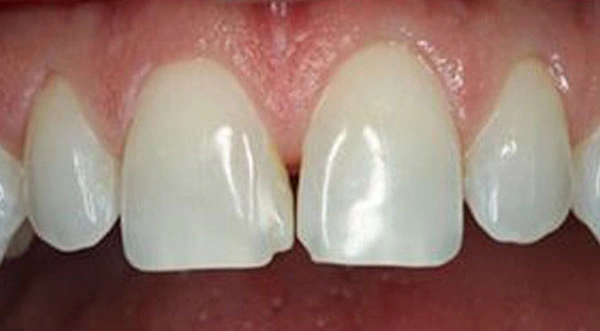 General Dentistry in San Jose